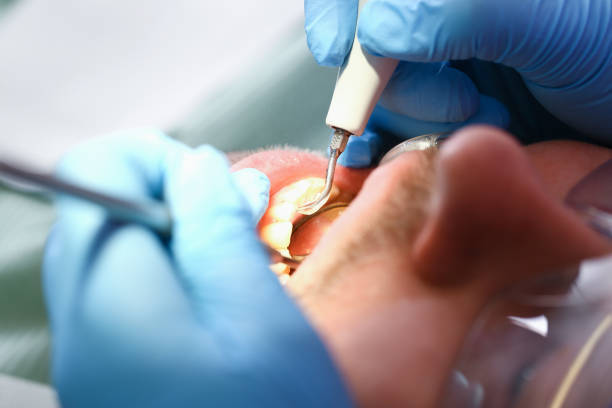 Best Mobile Emergency Dentist in North Beach Haven, NJ